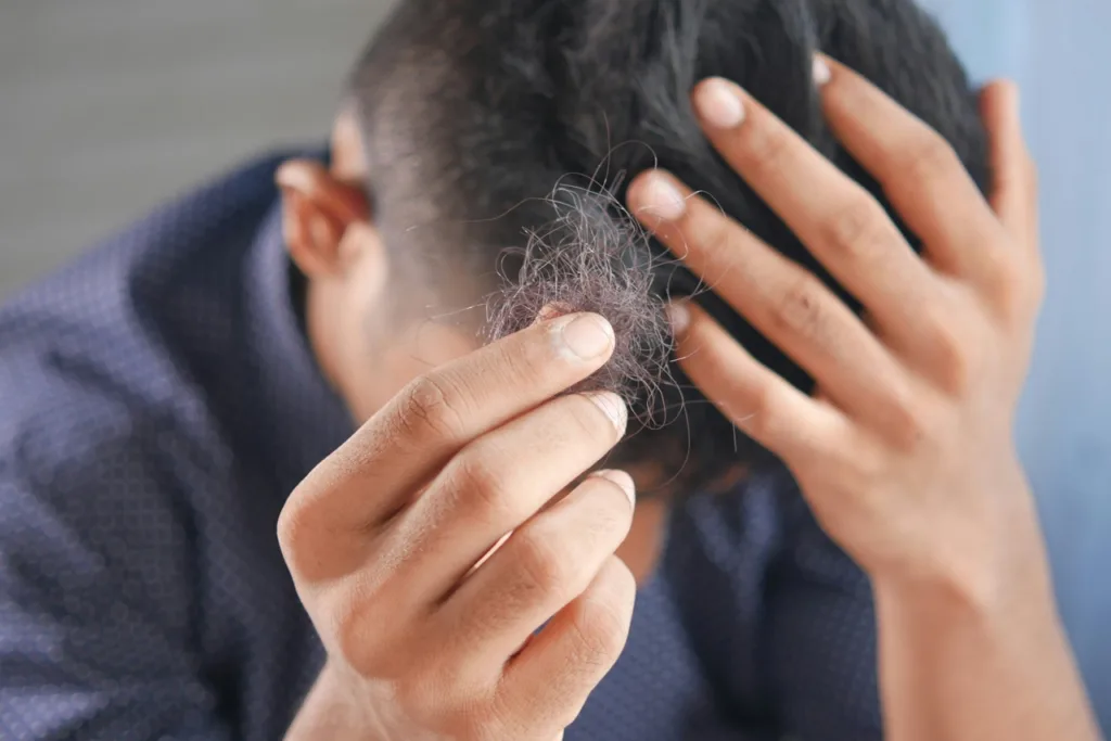 seseorang yang sedang memegang rambut rontok